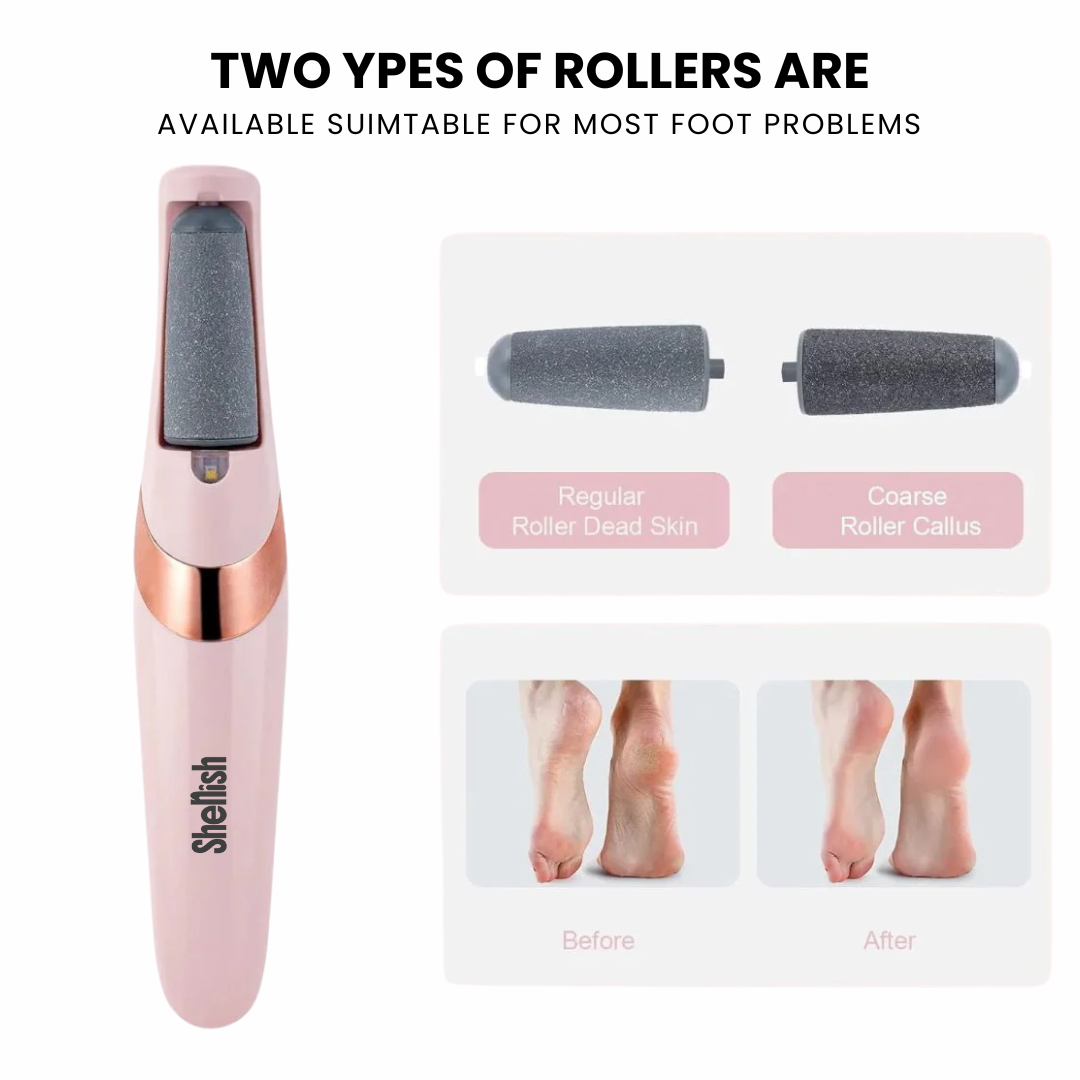 Callus Remover