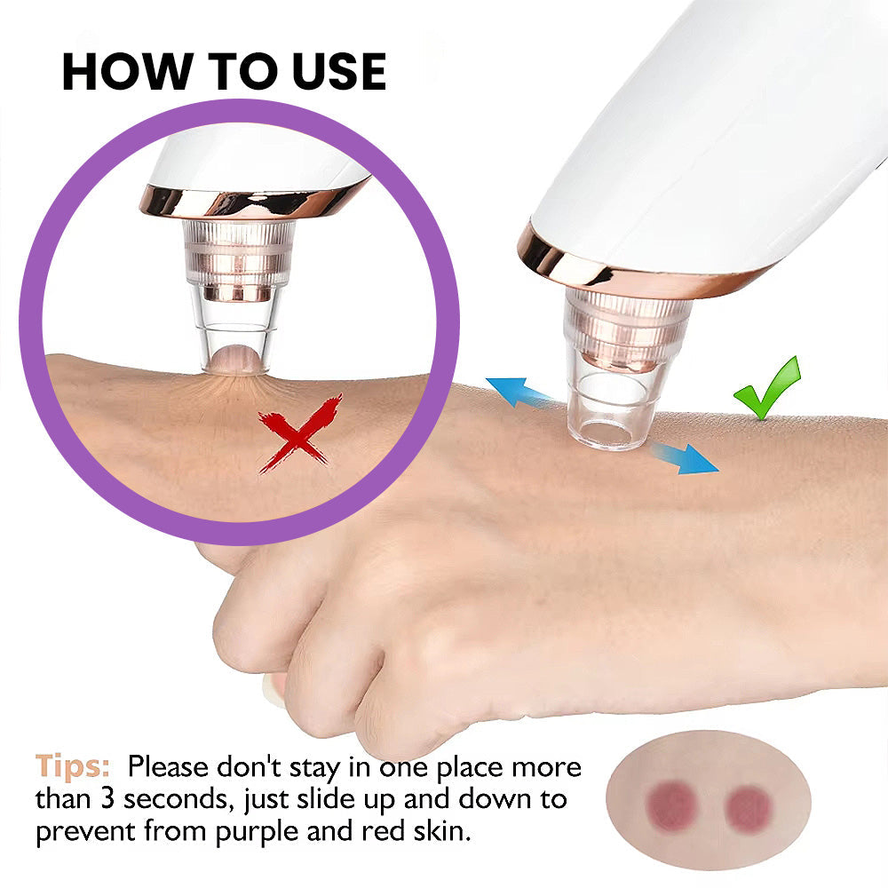 Imported™ Vacuum Pore Cleaner - Remove Blackheads Without Irritation or Redness