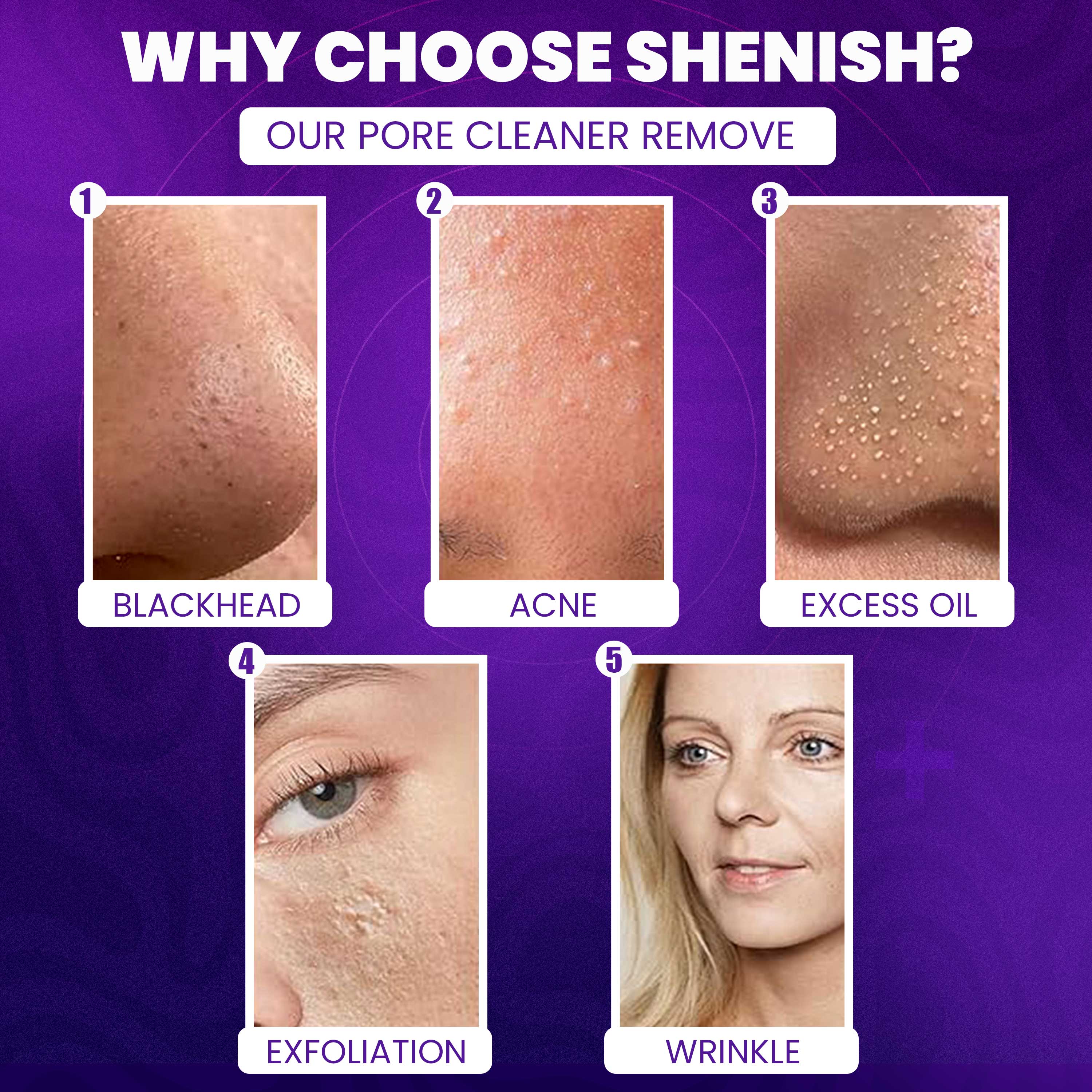 Imported™ Vacuum Pore Cleaner - Remove Blackheads Without Irritation or Redness